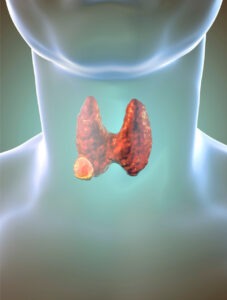 healthcare, health information, health news, Tagnam