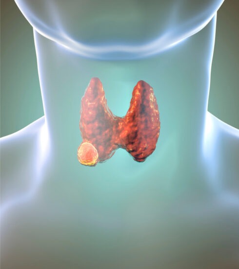 healthcare, health information, health news, Tagnam