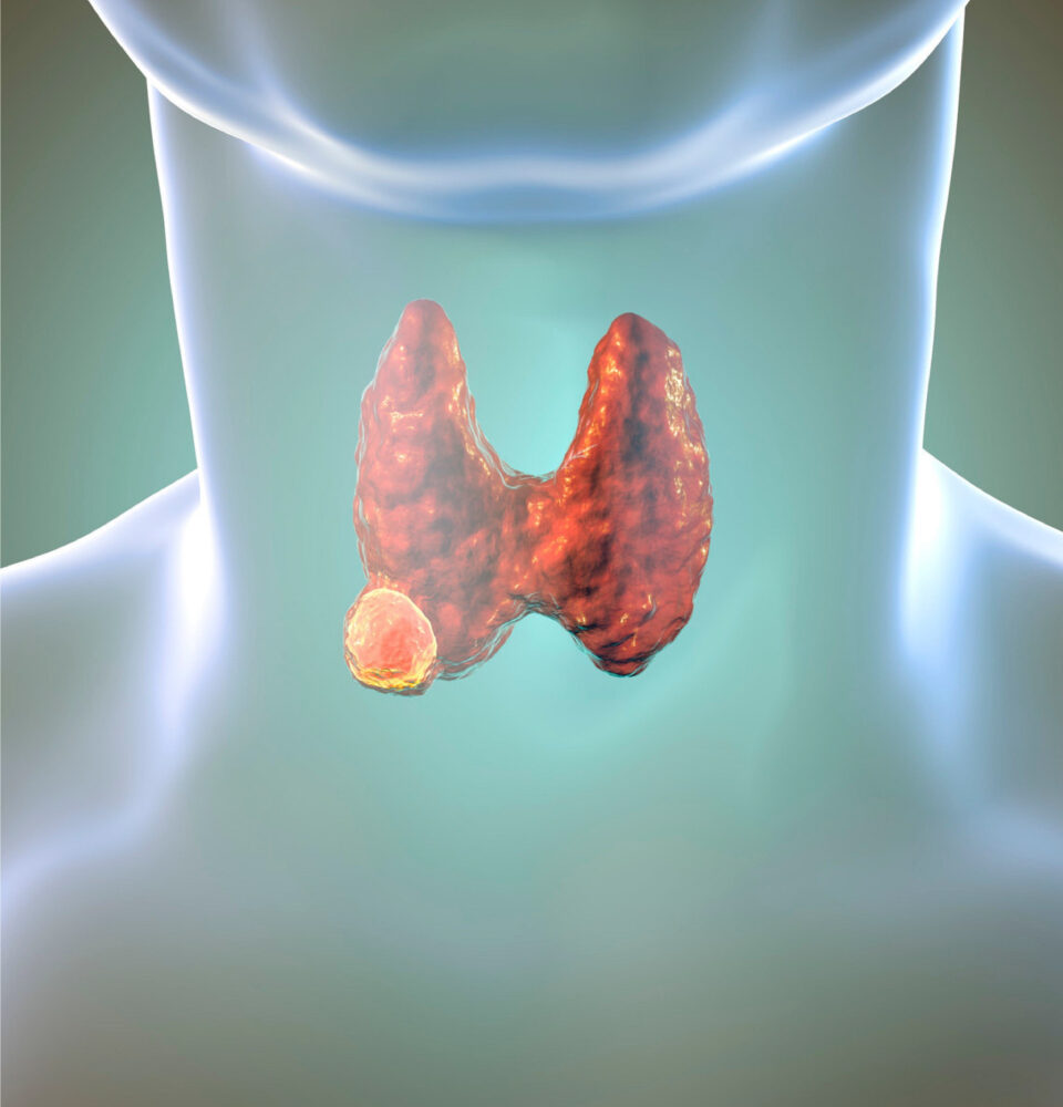 healthcare, health information, health news, Tagnam