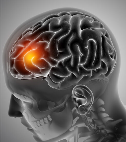 healthcare, health information, health news, Tagnam