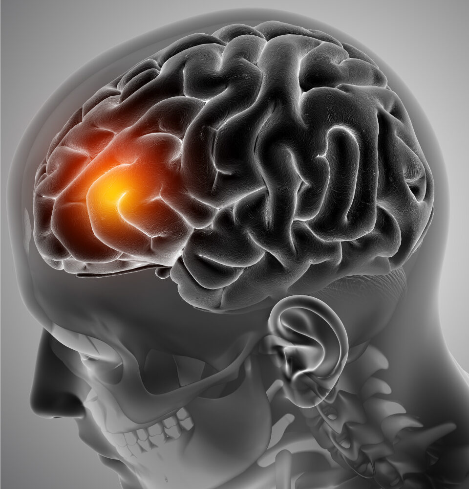 healthcare, health information, health news, Tagnam