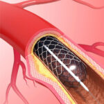 healthcare, health information, health news, Tagnam