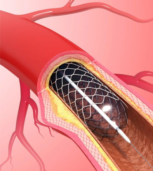 healthcare, health information, health news, Tagnam