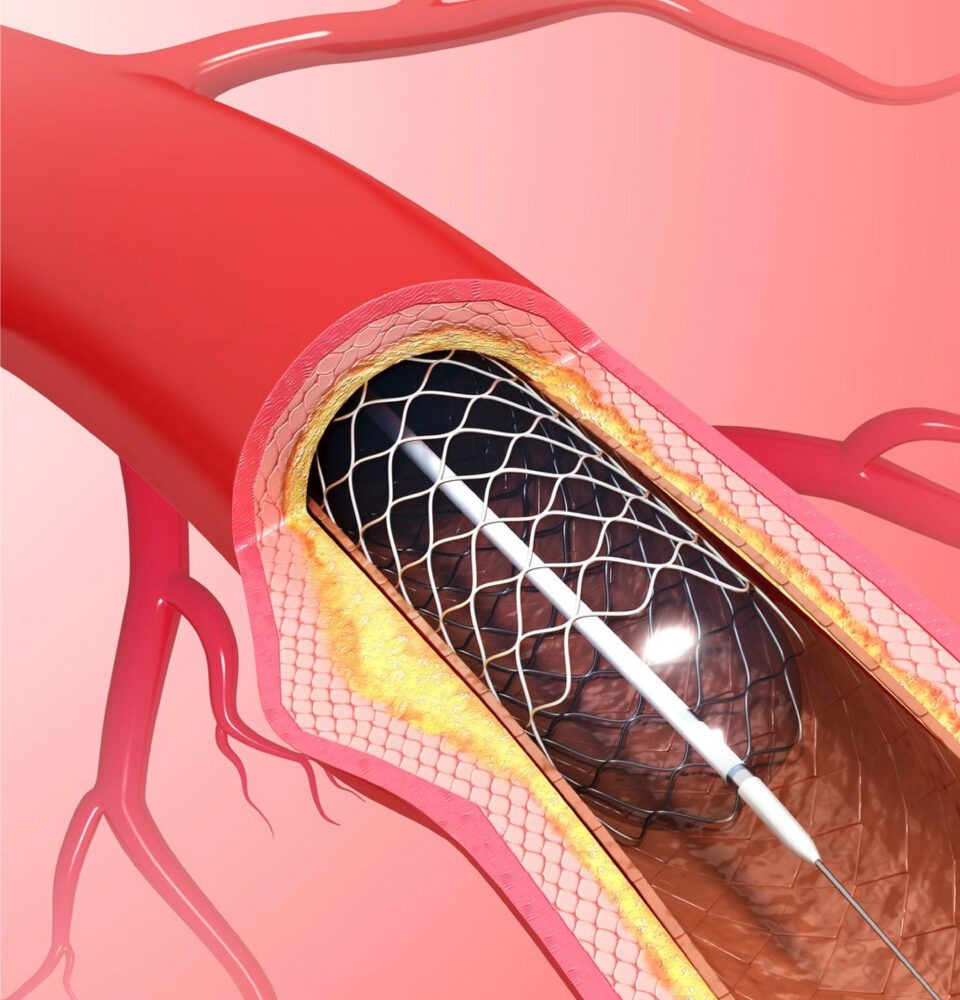 healthcare, health information, health news, Tagnam