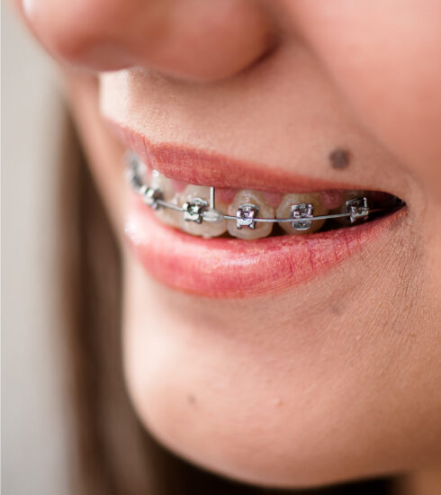 healthcare, health information, health news, Tagnam