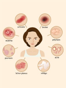 healthcare, health information, health news, Tagnam