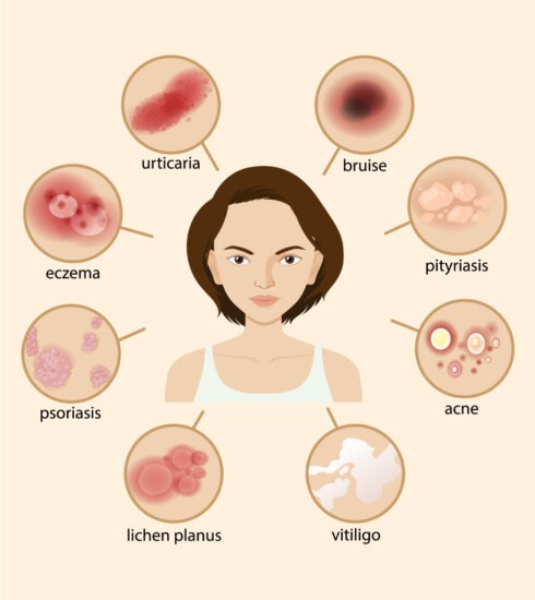 healthcare, health information, health news, Tagnam