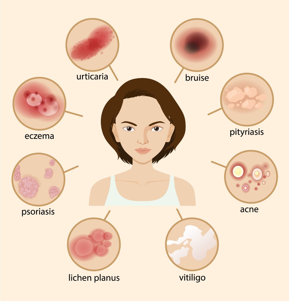 healthcare, health information, health news, Tagnam