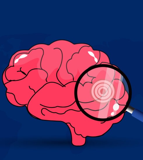 healthoscope, healthcare, health information, health news, Tagnam