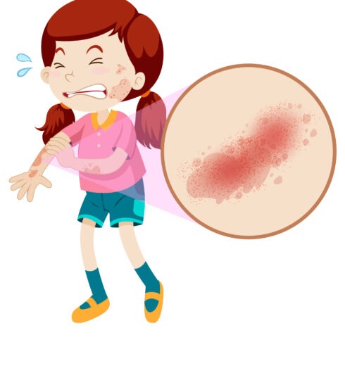 healthcare, health information, health news, Tagnam